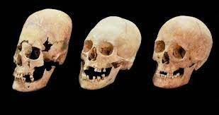 Theo quan niệm của người La Mã, những người có hộp sọ kéo dài thể hiện địa vị và quyền lực cao quý trong xã hội.