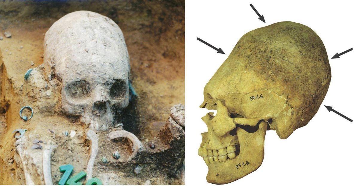 Những hộp sọ kéo dài của người La Mã trông giống như của người ngoài hành tinh mà chúng ta vẫn thấy trong các bộ phim khoa học viễn tưởng.