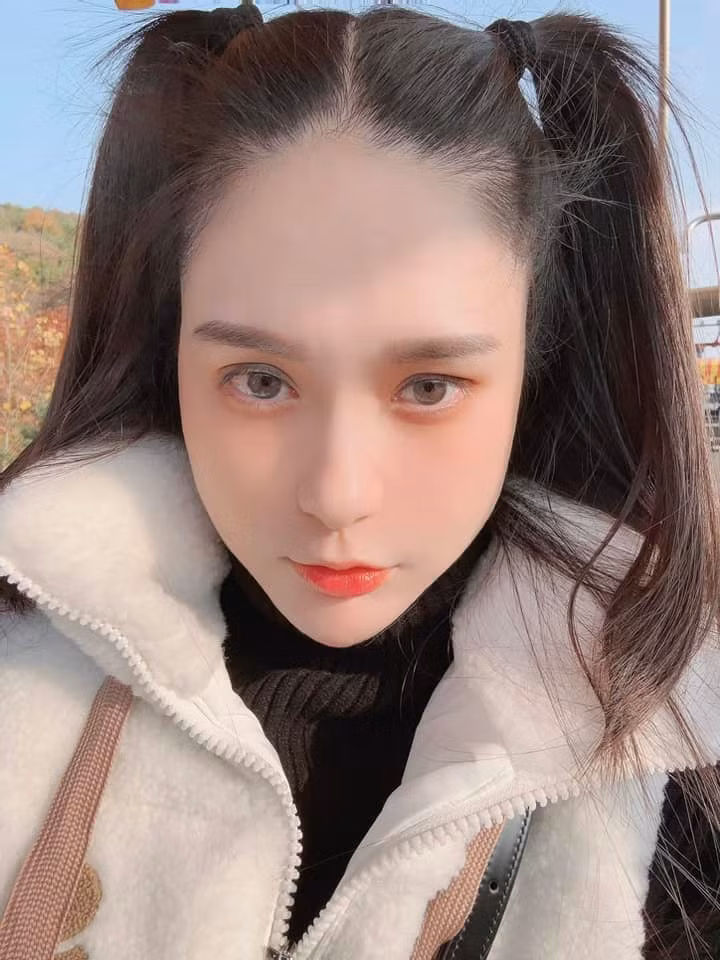 Để có vẻ ngoài "trẻ lâu", cựu nữ ca sĩ này tiết lộ không ngại sử dụng các phương pháp làm đẹp như tiêm filler, tế bào gốc... Ảnh: Tổng hợp