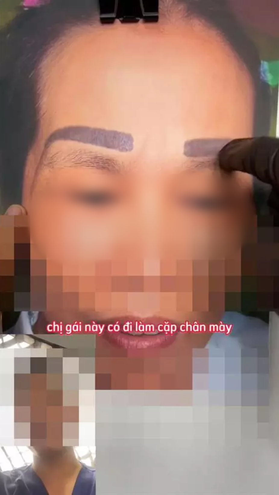 Mới đây trên mạng xã hội liên tục bàn tán về ca làm đẹp của một người phụ nữ. Theo thông tin đăng tải, chị này muốn xăm lông mày cho mặt thanh thoát hơn.