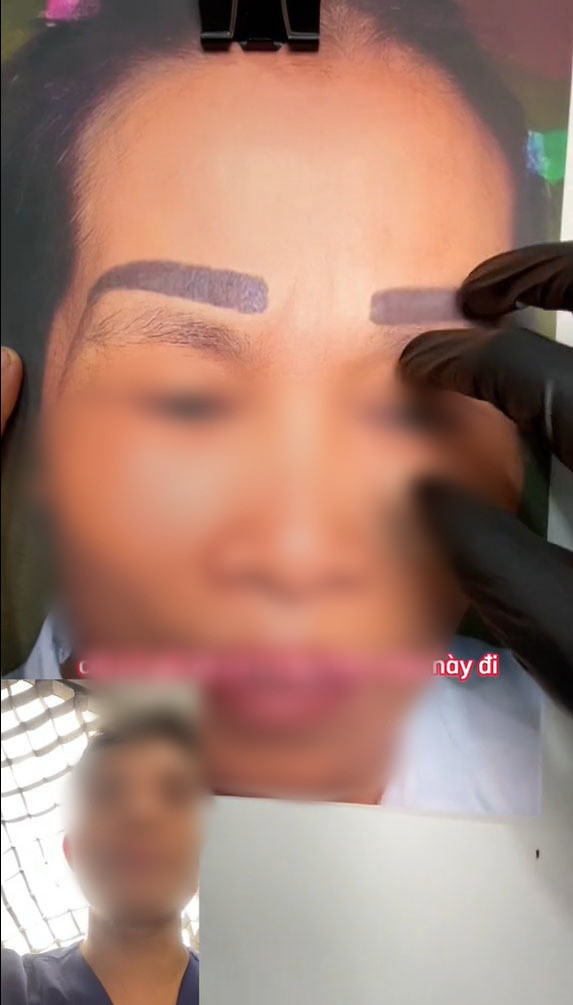 Thế nhưng, về được thời gian ngắn, lông mày cũ ở phía dưới lại mọc ra. Bây giờ, vô tình người phụ nữ có 2 cặp lông mày trên khuôn mặt. Không còn cách nào khác, chị đành đến cửa hàng mới để nhờ sửa lại.