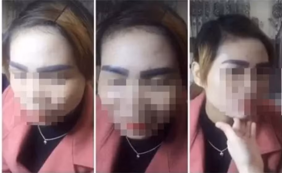 Một cô gái Việt Nam đã sang tận Lào để trải nghiệm mốt xăm lông mày mới nhất của nước này với khoảng 500.000 đồng. Lông mày làm từ “nước ngoài” này sẽ khiến cô ân hận suốt đời.