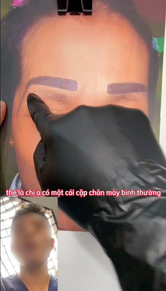 Theo đó, để cho lông mày đẹp hơn người thợ đã tiến hành cạo lông mày, sau đó xăm mới cao hơn cái cũ khoảng 1cm. Dường như, mục đích của thợ là muốn nâng cung chân mày.