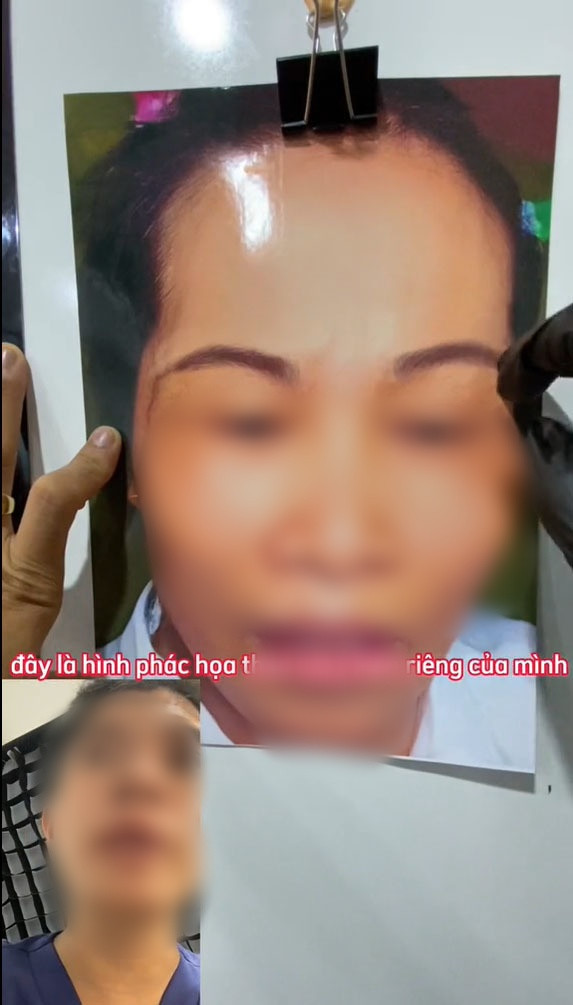 Ngoài ra, khi ý kiến với thợ xăm lông mày cũ, khổ chủ nhận được phản hồi: "Chị cứ giữ lại cả 2 cặp chân mày này đi. Nếu chị thích cặp lông mày dưới thì chị dùng kem che khuyết điểm để ẩn đi phần trên, nhự vậy chị có cặp chân mày bình thường. Còn nếu chị thích cái lông mày phía trên cao thì chị cạo bớt phần ở dưới đi".