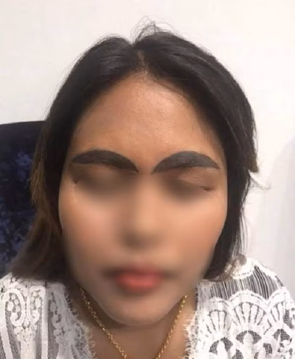 Khi thì lông mày quá sắc bén, khi lại lệch, hay có lúc lông mày nhỏ như que tăm… Muôn vàn trường hợp đã được đăng tải và cảm xúc khách hàng lúc đó là hoang mang tột độ.