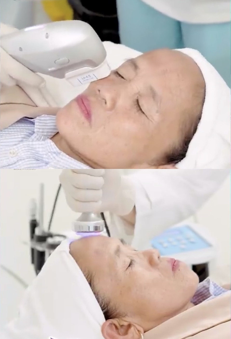 Ở một số clip, nhiều người còn không ngần ngại nhận xét gương mặt của bà bị sưng khác lạ.