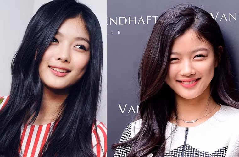 Tên tuổi của Kim Yoo Jung bắt đầu nổi tiếng khi tham gia các phim truyền hình: Iljimae, Dong Yi, Mặt trăng ôm mặt trời, May Queen, Secret Door và bộ phim điện ảnh The Chaser. Ngoài phim ảnh, Kim còn lấn sân sang làm MC và là người dẫn chương trình âm nhạc hàng tuần Inkigayo trên kênh SBS.