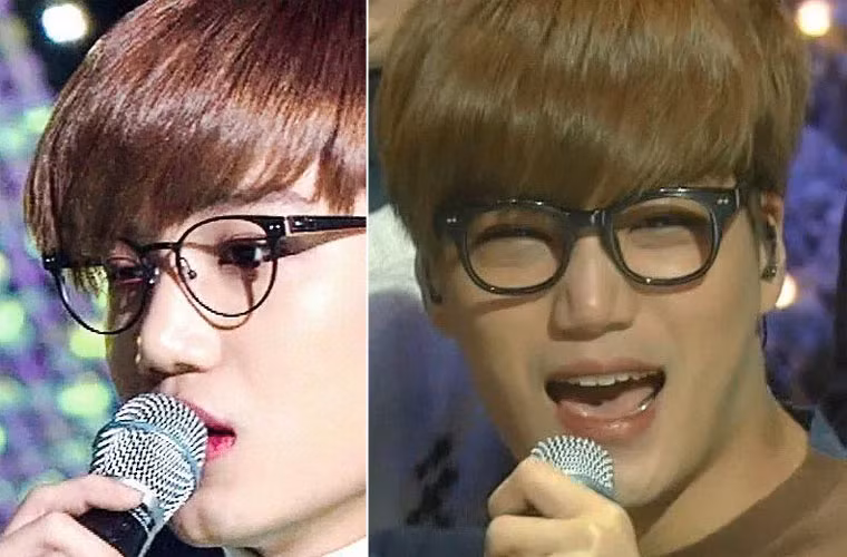 Nếu nhìn gần, bạn sẽ thấy một vết tím bên mắt phải, dường như đó là dấu vết phẫu thuật cắt mí.