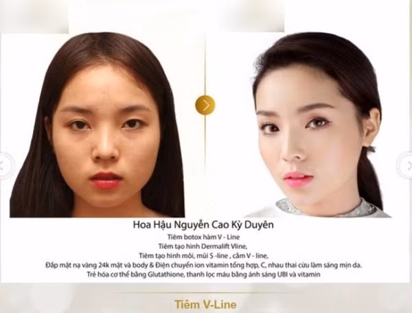 Muon kieu chung minh khong phau thuat tham my cua sao Viet-Hinh-3