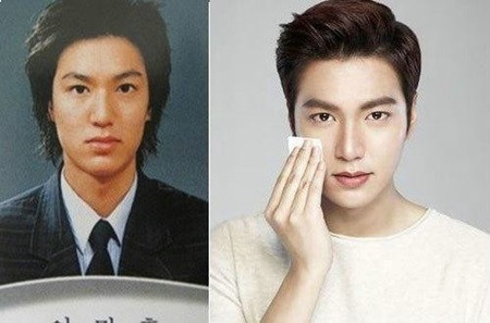 Loạt ảnh chứng minh các nam thần Hàn Quốc không thẩm mỹ - Hình 6 Loat anh chung minh cac nam than Han Quoc khong tham my-Hinh-6