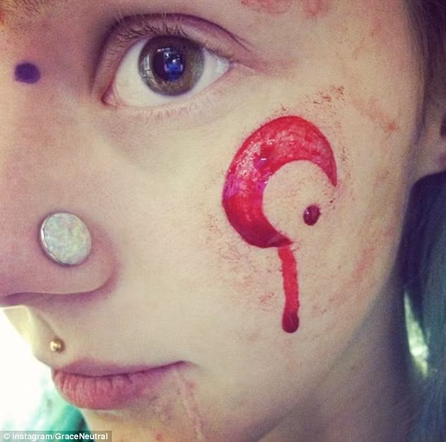 Mất một tuần để vết thương lành lại và mặc dù phải chịu đựng đau đớn nhưng Grace vẫn cố gắng thực hiện quy trình “Cải tạo cơ thể” quái dị này. Cô ấy cũng cân nhắc việc loại bỏ núm vú, nhưng được khuyên là không nên vì có quá nhiều rủi ro trong quá trình thực hiện.