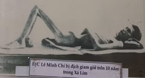 Cựu tù này bị cho nhịn đói đến nỗi chỉ còn da bọc xương.
