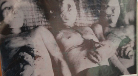 Những hình ảnh mổ bụng moi gan gây ám ảnh.