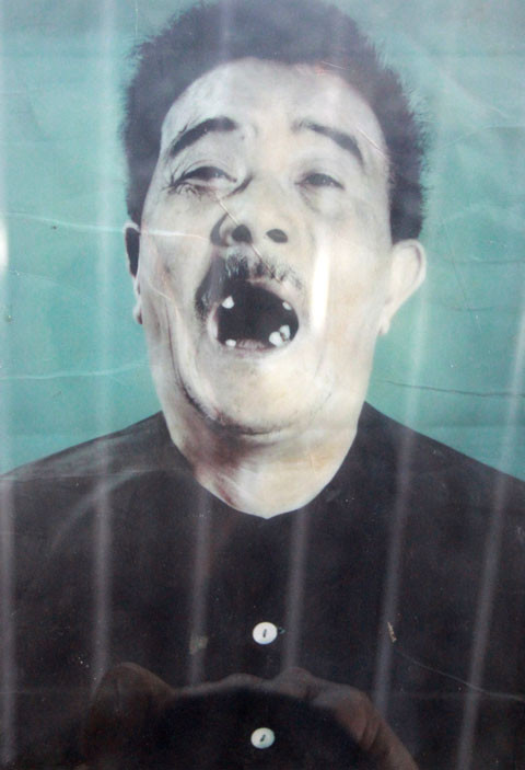 Một cựu tù bị cai ngục đục răng nham nhở.