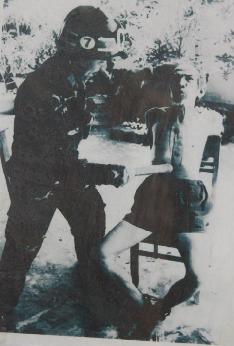 Thúc gậy gẫy xương sườn.