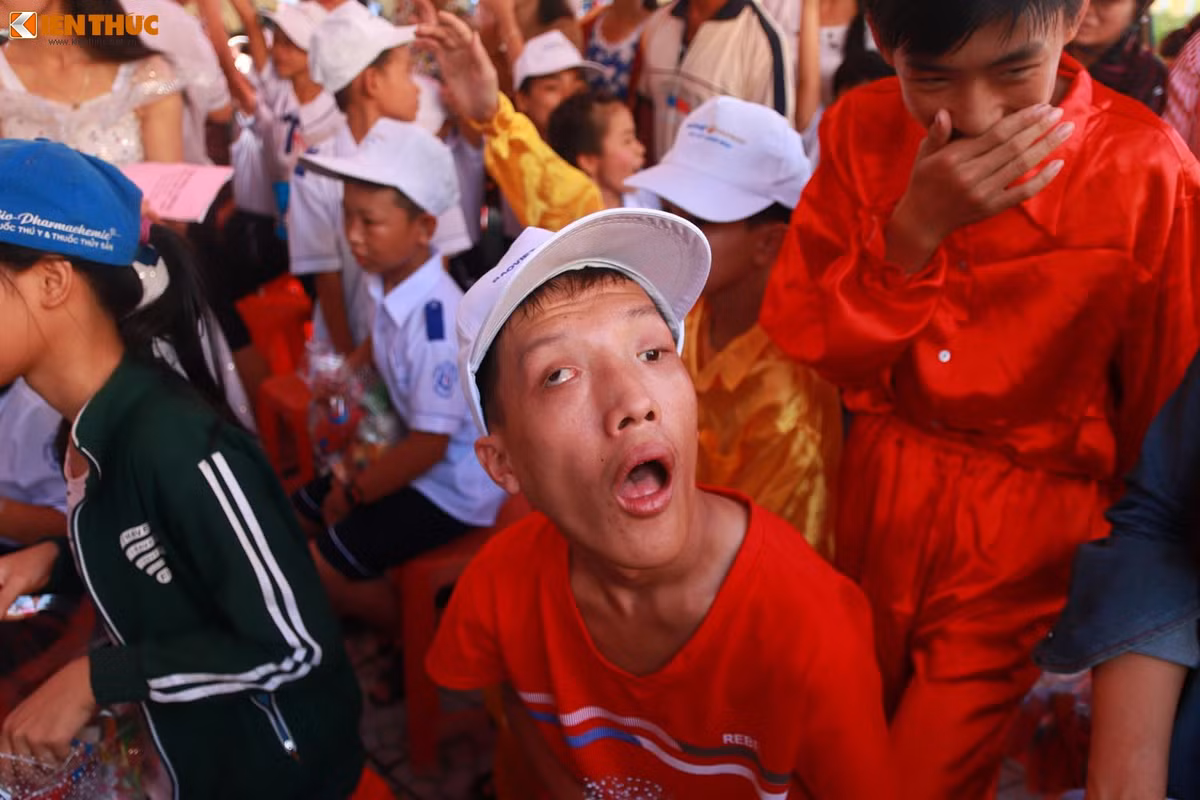 Cuộc sống của các em không may mắn như các bạn khác nên cần được sự quan tâm nhiều hơn nữa của xã hội. Ảnh: Quốc Minh.