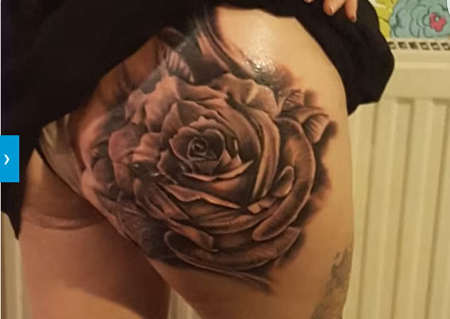 Ngoài việc lúc nào cũng khổ sở vì lo lắng, bà mẹ này đã phải chịu đựng những biến chứng của bệnh đường ruột mãn tính này từ khi mới 20 tuổi. Vùng áp xe của cô sâu tận 5cm và phải phẫu thuật nhiều lần trong vòng 6 tuần mới hết. 