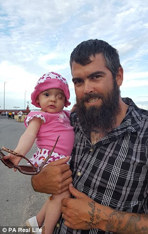 Nghiên cứu tiền sử gia đình cho thấy bố và một người cụ cách bé 3 đời cũng bị tình trạng tương tự. Nhưng dị tật mắt nhỏ cũng có thể do những yếu tố khác như thiếu vitamin trong thai kỳ hoặc tác động của bức xạ. 