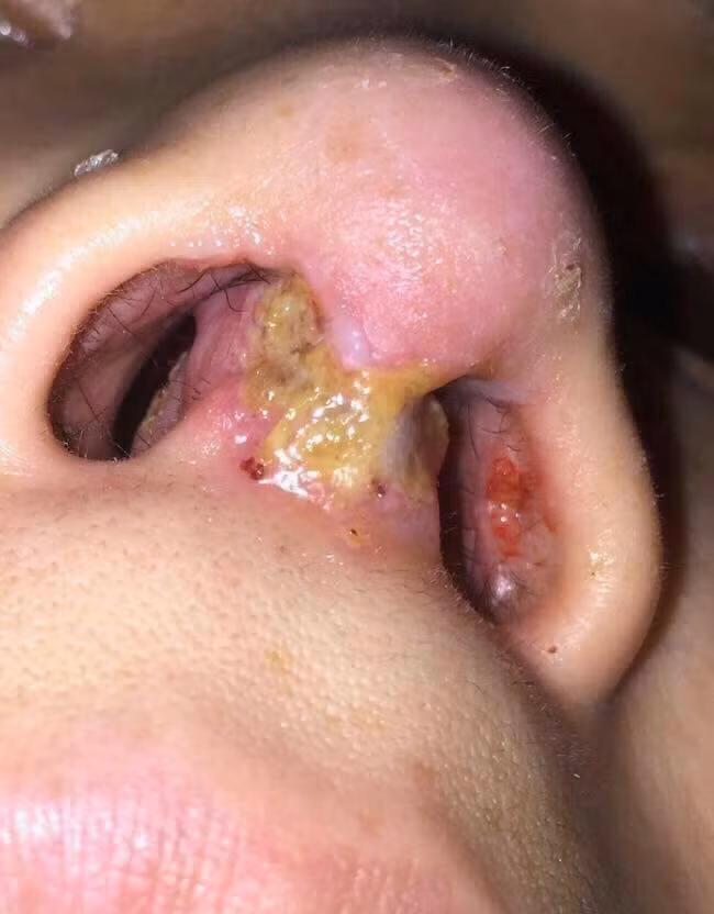 Những hình ảnh ghê người này bỗng lan tràn trên mạng xã hội vì một lý do nào đó và không ai biết rõ câu chuyện là gì.