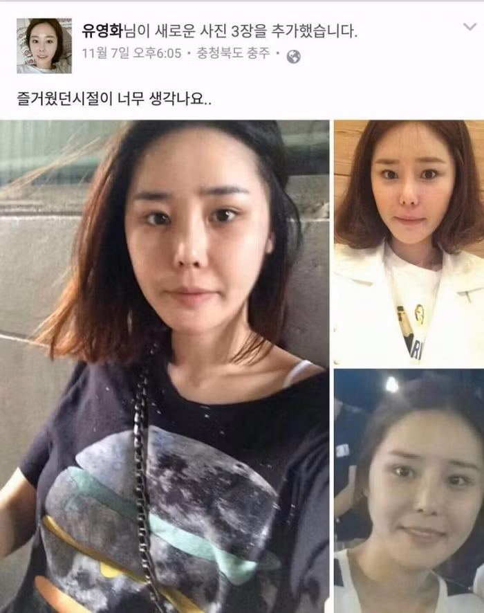 Đây là hình ảnh xinh đẹp của một cô gái người Hàn Quốc trước khi gặp phải tai nạn phẫu thuật thẩm mỹ.