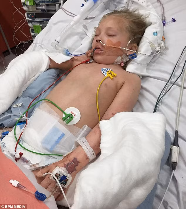 Những tấm ảnh này cho thấy bệnh viêm màng não B đã tấn công khủng khiếp cơ thể của một học sinh tiểu học chỉ vài ngày sau khi được chứng kiến đám cưới của bố mẹ mình. 