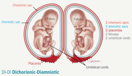 Nghiên cứu cho thấy các cặp sinh đôi khác trứng nên chào đời vào tuần 37 vì chỉ muộn hơn 1 tuần là tỉ lệ tử vong trẻ sơ sinh sẽ tăng thêm 8,8%. 