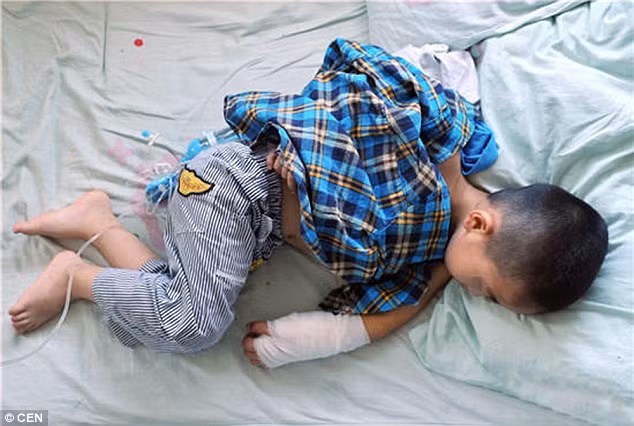 Đến tận tháng 4/2016 gia đình tiếp tục đưa bé vào bệnh viện Thành Đô, tại đây một bác sĩ cho biết đó là một vết sẹo và có thể ảnh hưởng đến sự phát triển của bé. Kế hoạch được đưa ra là em bé sẽ được cho uống thuốc và 3 tháng sau sẽ được phẫu thuật để loại bỏ vết sẹo. 