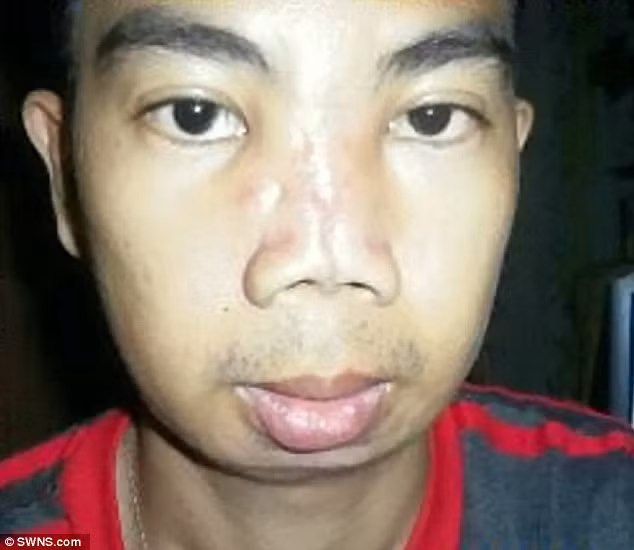 Ellowe giờ đây chỉ ao ước mình có thể lấy lại chiếc mũi không hoàn hảo lăm như trước kia nhưng đã quá muộn.