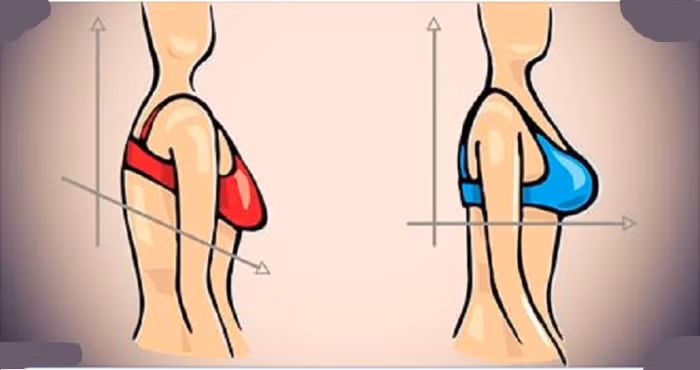 Tương tự như phẫu thuật thu nhỏ ngực, phẫu thuật nâng ngực có tác dụng nâng đầu ngực và làm da săn lại nhờ loại bỏ bớt da ngực và giữ lại các tế bào ngực, nhờ đó vòng 1 được định hình lại. Phẫu thuật nâng ngực không có tác dụng tăng hay giảm kích thước ngực và chỉ tái tạo lại hình dáng ngực. 