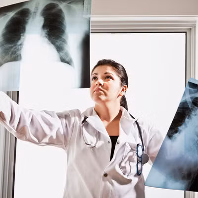 Đối với những cơn ho không đáp ứng với điều trị kể trên, cần chụp cắt lớp hoặc X-quang vùng ngực để kiểm tra xoang và phổi nhằm xác định chắc chắn bạn không bị phổi tắc nghẽn mãn tính hoặc ung thư phổi. 