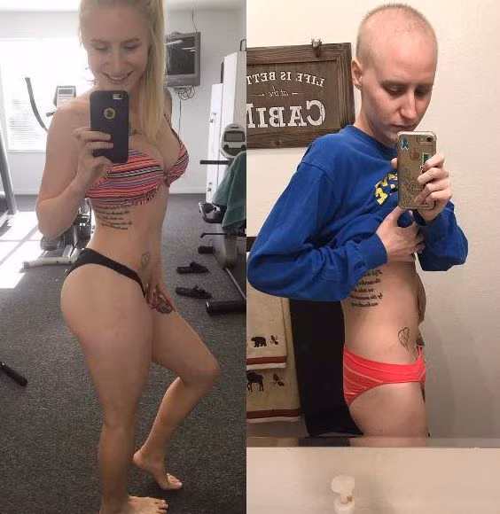 Một người mẫu thể hình đang phải chiến đấu với căn bệnh ung thư buồng trứng đã khiến cộng đồng mạng nổ tung sau khi đăng tải những tấm ảnh thực tế về quá trình chống chọi với căn bệnh ung thư của mình trên mạng xã hội.