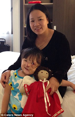 Bé gái người Việt bẩm sinh đã mang một khối u chết người trên mặt cuối cùng đã có thể mỉm cười và sống một cuộc sống hoàn toàn khác sau khi được một nhà hảo tâm người Mỹ động lòng trắc ẩn làm hết sức mình để có đủ chi phí phẫu thuật.