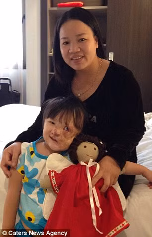 Bé gái người Việt bẩm sinh đã mang một khối u chết người trên mặt cuối cùng đã có thể mỉm cười và sống một cuộc sống hoàn toàn khác sau khi được một nhà hảo tâm người Mỹ động lòng trắc ẩn làm hết sức mình để có đủ chi phí phẫu thuật.