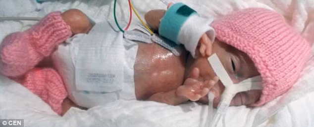 Be so sinh nho nhat the gioi chi nang bang qua ot chuong-Hinh-2