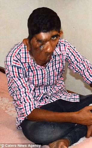 Mặc dù được đặt biệt danh “người mặt voi” nhưng bạn bè và gia đình của Bhupinder cho biết cũng giống như những thanh niên mới lớn khác, cậu luôn tràn đầy năng lượng và còn học chơi cricket.