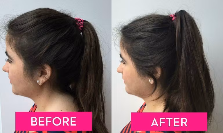 Mái tóc vừa dài vừa dày khi buộc lên sẽ rất dễ rũ xuống. Bạn cần thêm 2 chiếc kẹp tăm kẹp vào phần chun buộc tóc theo chiều ngược lên. Ngay lập tức kiểu tóc của bạn trông sẽ dày và cao hơn.