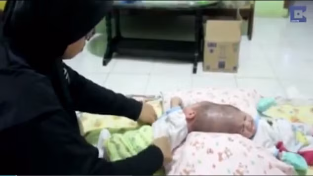 Bố mẹ của cặp song sinh này đều đã 30 tuổi, hàng ngày phải chứng kiến con mình không được sống như những đứa trẻ bình thường khác là một điều rất khó khăn. Họ đang rất mong chờ ca phẫu thuật tách rời hai chị em để trả lại cho các bé một cuộc sống tự do. 