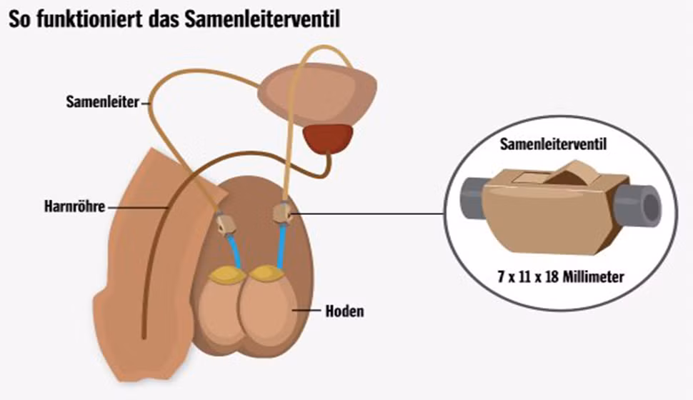 Có lẽ không cần quan tâm đến hình thù của dụng cụ này vì thực ra dụng cụ y tế nào trông cũng không tinh tế cho lắm. Điều đáng nói về thiết bị này chính là cái nút bật tắt kia sẽ gây khó khăn cho người nào dám sử dụng khi mà đàn ông nhiều khi vô tâm tới mức chẳng nhớ nổi trong nhà mình, cái nào là công tắc đèn, cái nào là công tắc quạt. 