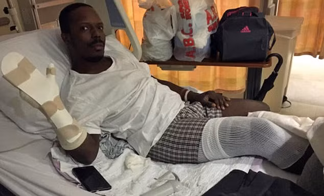 Nạn nhân đen đủi này là Otis Gooding, 31 tuổi, đã được xuất viện sau khi điều trị tại Trung tâm trị bỏng thuộc một bệnh viện tại New York. Khi xuất viện, anh này vẫn phải ngồi xe lăn, chân tay băng bó. 