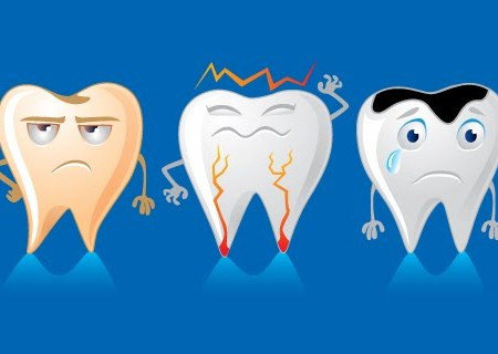 Triclosan là một thành phần phổ biến khác có trong kem đánh răng. Đây cũng là một chất kháng khuẩn được chứng minh có tác dụng làm giảm các mảng bám trên răng. Mặc dù Mỹ đã cấm sử dụng triclosan trong xà phòng nhưng vẫn chấp nhận triclosan là một thành phần của kem đánh răng. 