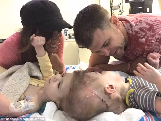 Sáu tuần sau phục hồi, hai bé được chuyển đến một cơ sở phục hồi. Đây là khoảng thời gian hồi phục sau phẫu thuật ngắn nhất của cặp sonh sinh dính liền đầu, phá kỷ lục từng có trước kia là 8 tuần. 