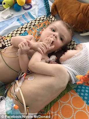 Hiện tại bé Jadon đã có thể cử động được và đã trở lại với kiểu sôi nổi, năng động và đầy năng lượng như trước kia. Còn bé Anias trước phẫu thuật vốn đã tương đối chật vật trước phẫu thuật hiện đang khó khăn hơn vì thường xuyên bị nhiễm virus và viêm.