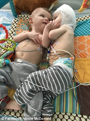 Bé Anias đã là người phải gánh rủi ro khi hồi phục chậm hơn và vẫn còn phải gắn ống thở. Tất cả những nguy cơ này đều đã được cảnh báo trước. 