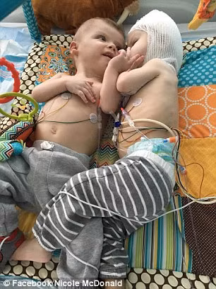 Bé Anias đã là người phải gánh rủi ro khi hồi phục chậm hơn và vẫn còn phải gắn ống thở. Tất cả những nguy cơ này đều đã được cảnh báo trước. 