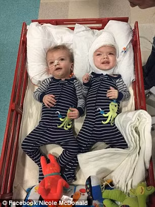 Nhưng bác sĩ phẫu thuật cho hai bé tin rằng vé Anias sẽ vượt qua và giờ Jadon chính là nguồn năng lượng lớn nhất đối với Anias. 