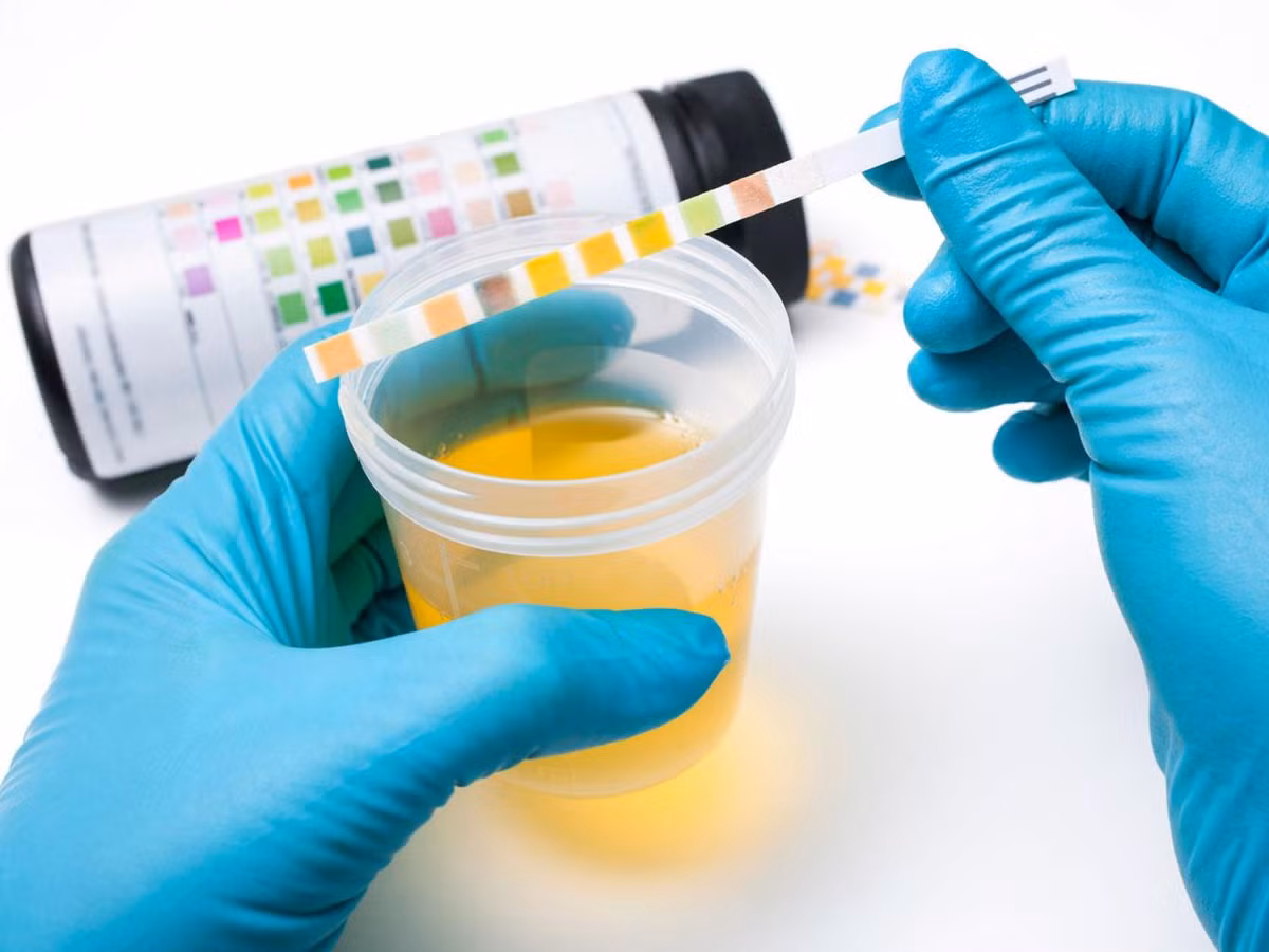 Có tên gọi là mặt nạ nước tiểu, những người muốn thực hiện phương pháp làm đẹp tại nhà này chỉ cần lấy nước tiểu của mình thấm vào một miếng vải hoặc một miếng bông rồi lau đi lau lại trên mặt, sau đó đợi mặt khô rồi rửa sạch bằng nước. 