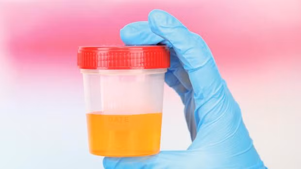 Những người đã tình nguyện thử phương pháp làm đẹp này khẳng định ure và axit uric có trong nước tiểu có rất nhiều tác dụng, từ làm sạch tế bào chết đến giúp cơ thể hấp thu những chất đã bị mất qua đường tiểu. Tuy nhiên những điều này không thuyết phục được các chuyên gia và những người đã từng thử nghiệm cũng chưa đạt được kết quả mọi mặt như mong muốn. 