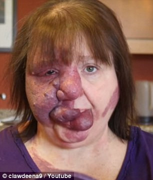 Nhưng không vì gương mặt dị dạng mà bà cảm thấy thiếu tự tin. Bỏ qua mọi ánh nhìn tò mò và những lời bình luận không mấy thiện cảm, bà luôn muốn ra đường với một khuôn mặt xinh đẹp nhất có thể. 