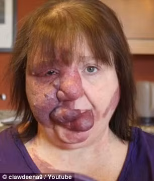 Nhưng không vì gương mặt dị dạng mà bà cảm thấy thiếu tự tin. Bỏ qua mọi ánh nhìn tò mò và những lời bình luận không mấy thiện cảm, bà luôn muốn ra đường với một khuôn mặt xinh đẹp nhất có thể. 