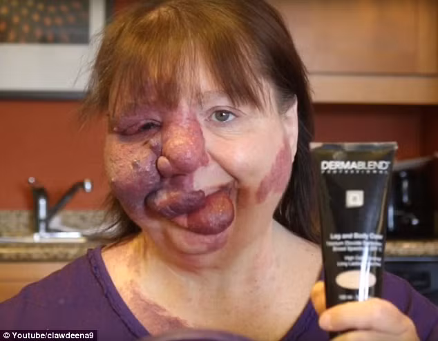 Bà bắt đầu trang điểm khuôn mặt với kem nền Dermablend, một sản phẩm bà cho rằng có tác dụng che phủ những khuyết điểm lớn như mụn đỏ, hình xăm và bớt.